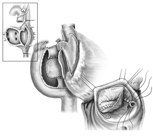Cardiothoracic Illustrations