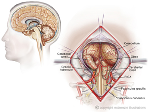 Neurological Illustrations